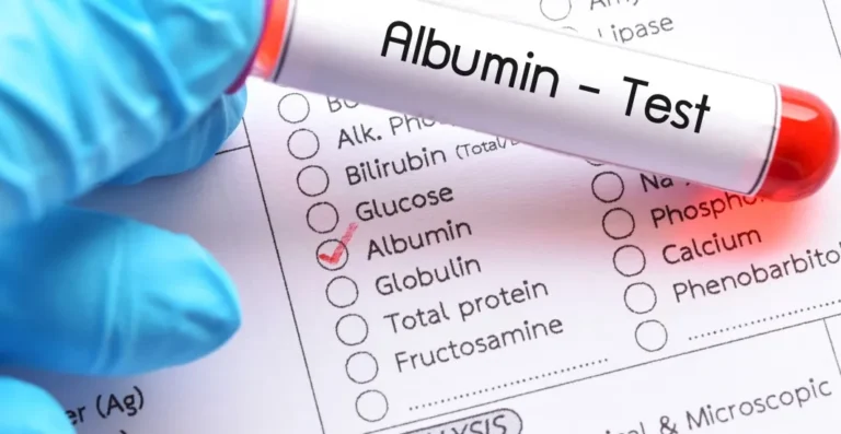 Albumin: Reference Range and Interpretation